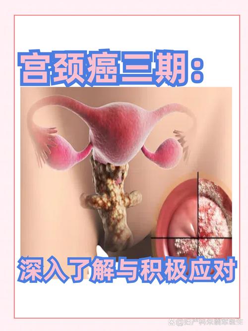 女人为什么会得宫颈癌?