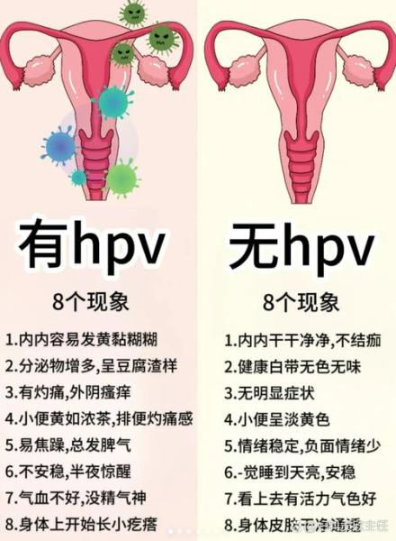 HPV几乎每个女人都感染吗